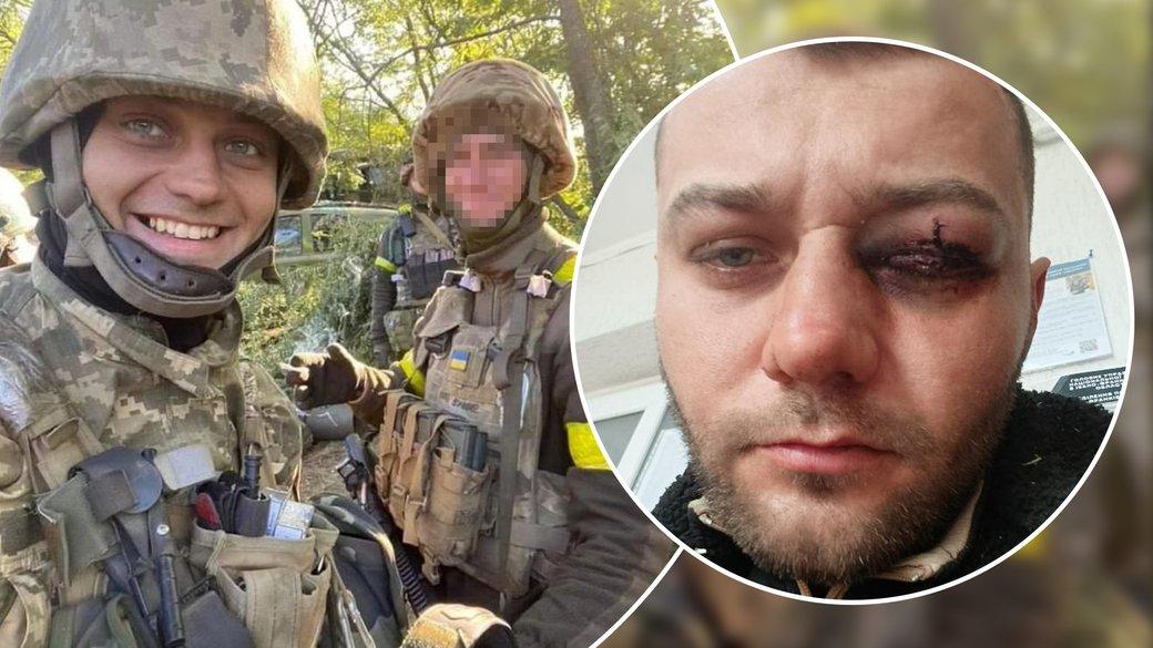 «Думають, що “здаю” їх у ТЦК»: на Івано-Франківщині шестеро чоловіків напали на ветерана