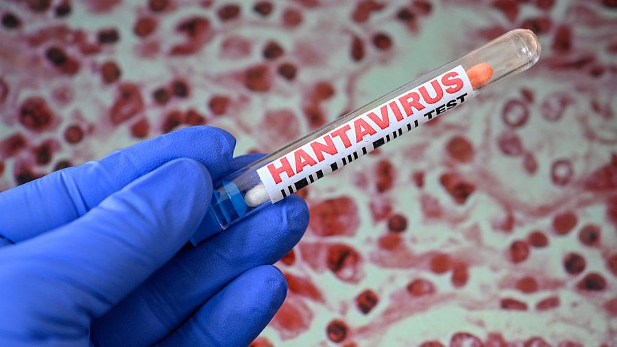 «Andes virus в Україні відсутній і не може тут закріпитися», — Центр громадського здоров’я