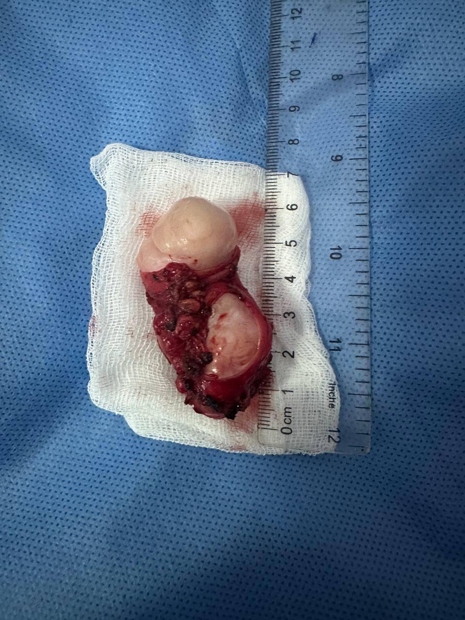 фото під час проведення операції