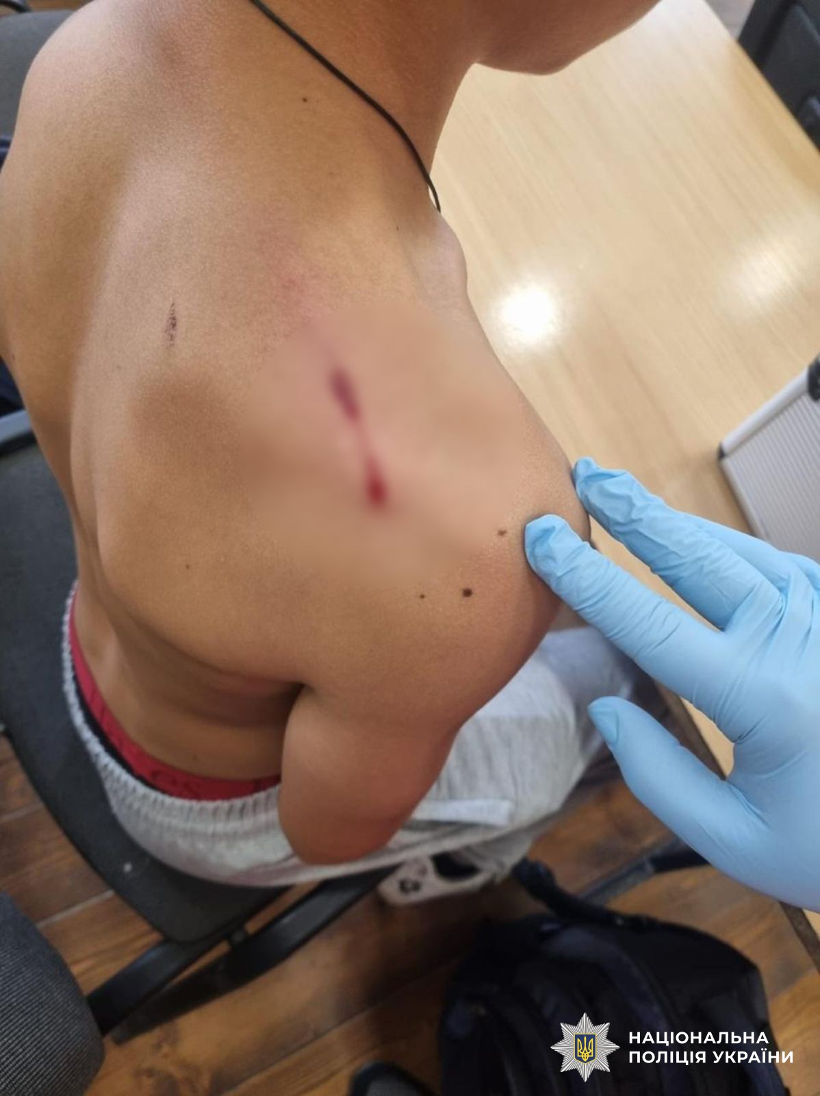 фото: поранення