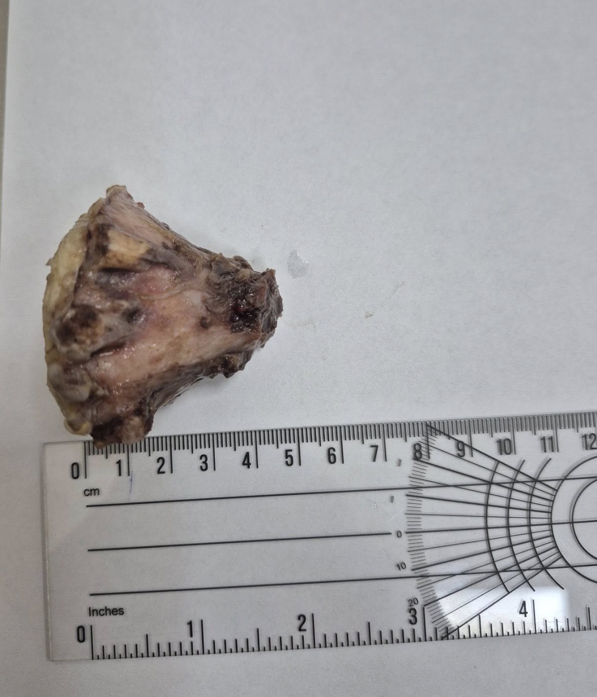 Пухлиноподібне утворення